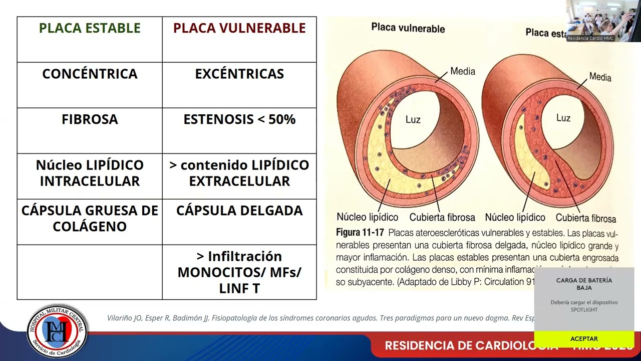 SINDROME CORONARIO AGUDO-PLACA CORONARIA