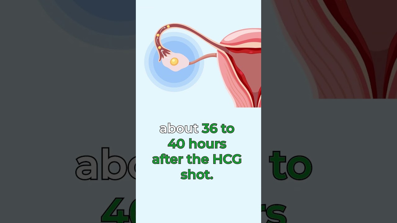How Many Hours After an hCG Shot Do You Ovulate?