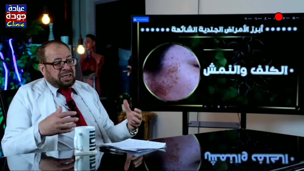 أشهر الأمراض الجلدية | دكتور جودة محمد عواد | دكتور جودة محمد عواد