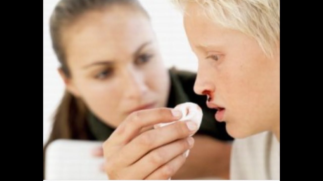 Votre enfant saigne du nez? Que faire?