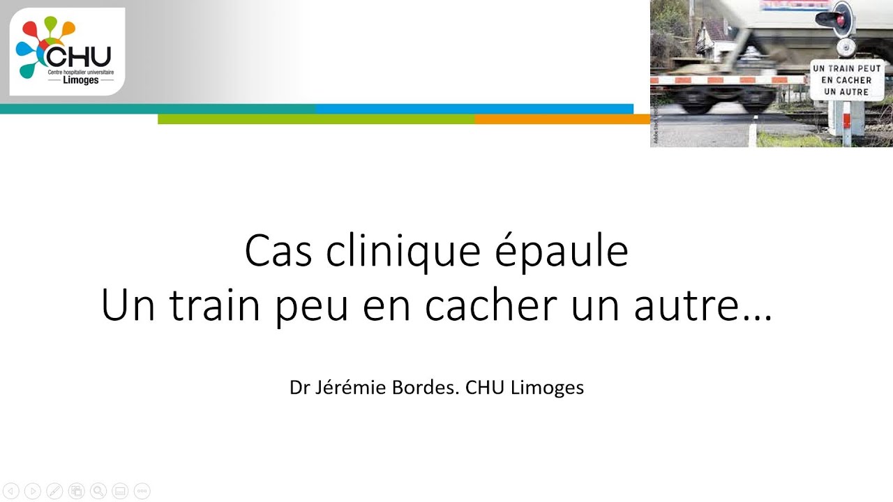 Cas clinique épaule: Un train peut en cacher un autre