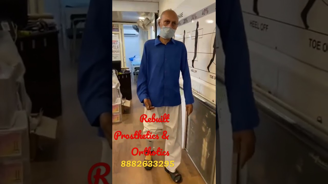 Below Knee Prosthesis🦿#newlife #zest #rebuildingstories