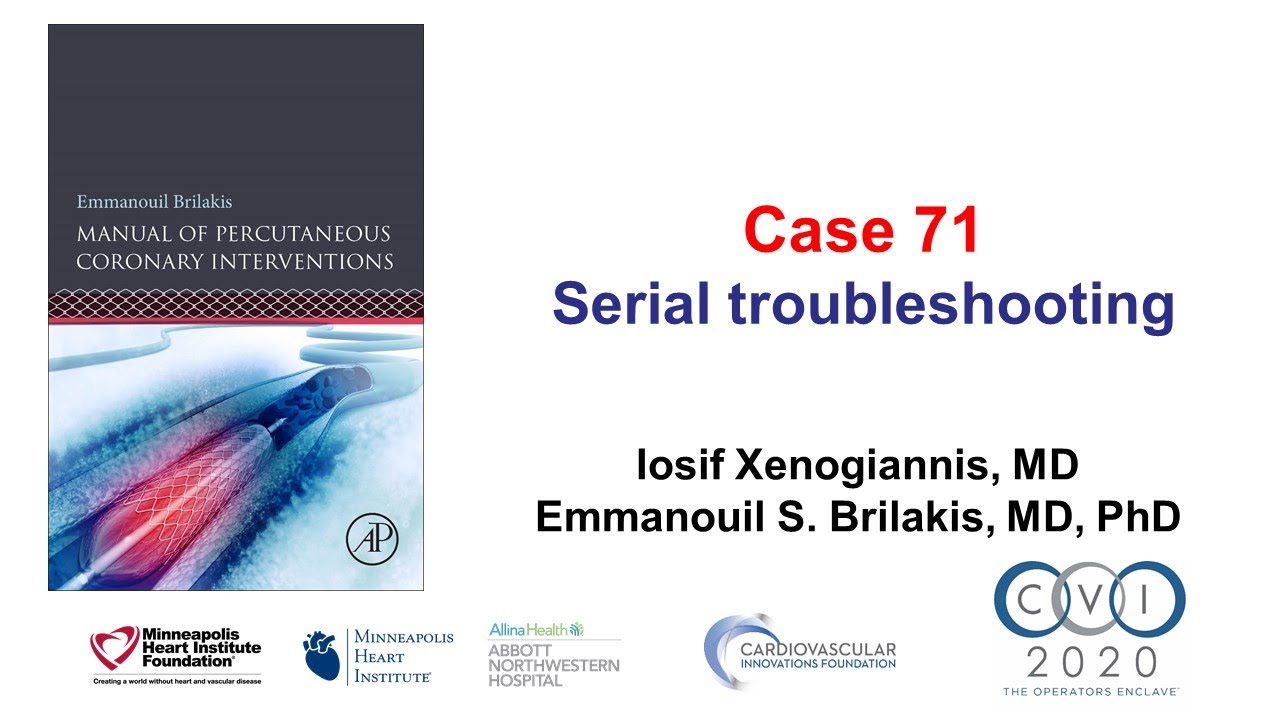 Case 71: PCI Manual - Serial troubleshooting