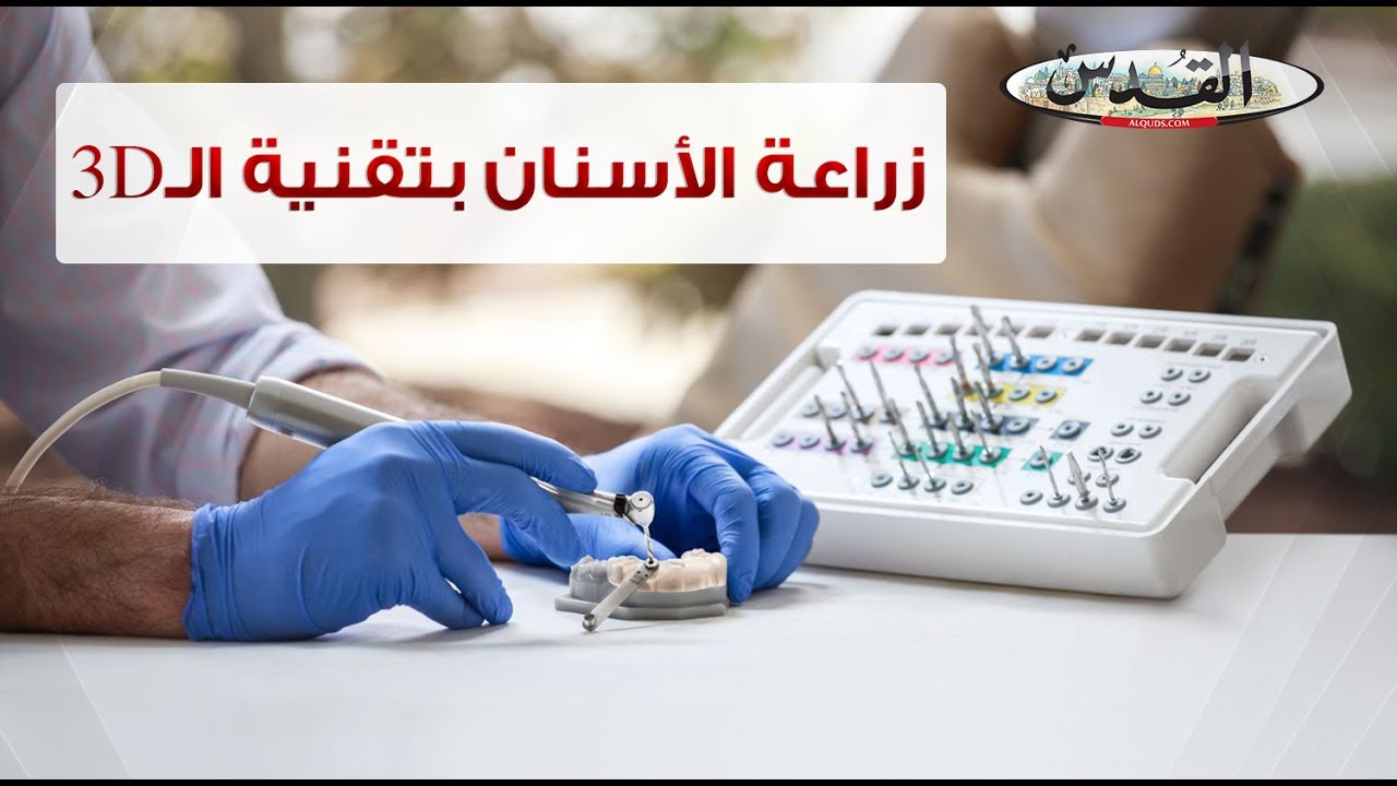 الطباعة ثلاثية الأبعاد ثورة في طب الأسنان