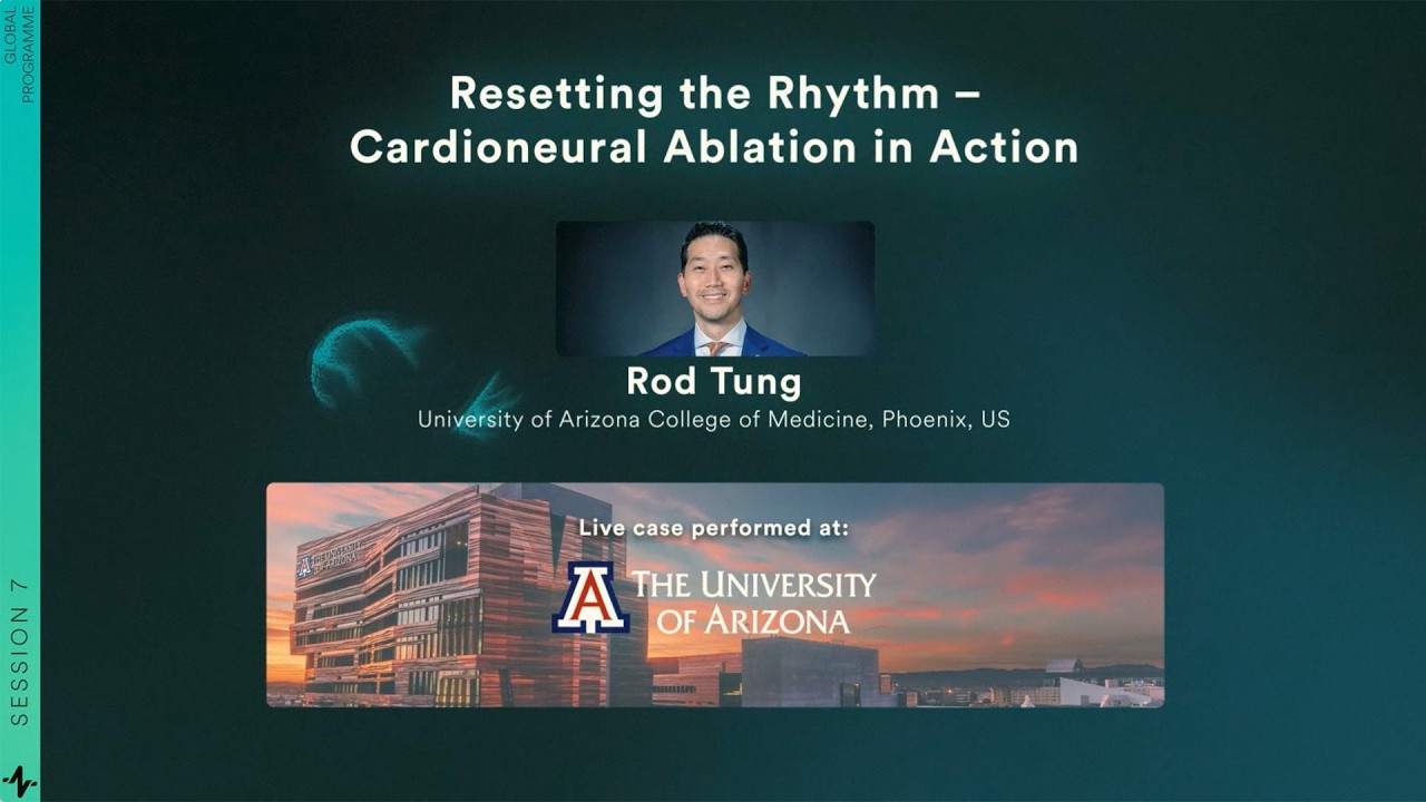 Live Case & Discussion: Resetting the Rhythm – Cardioneural Ablation in Action | RIO 2025