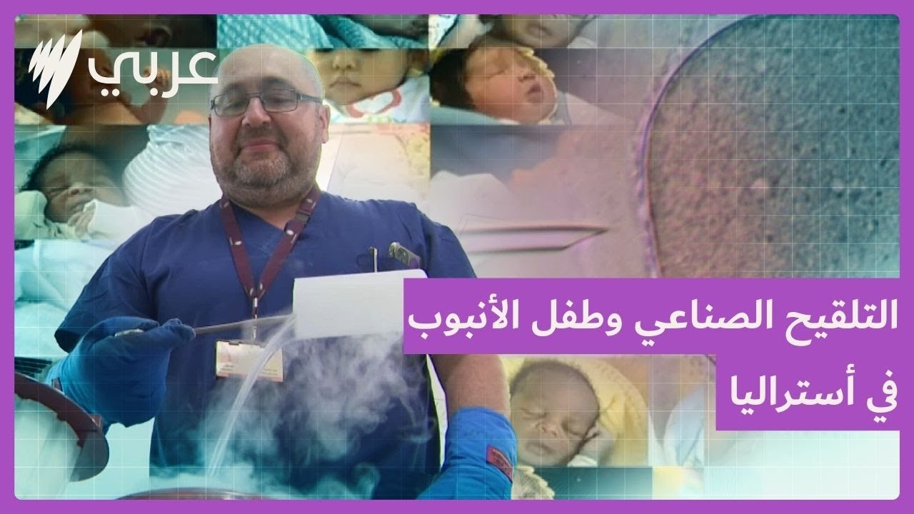 التلقيح الصناعي.. خيار طبي يثير الجدل لدى كثير من الأزواج