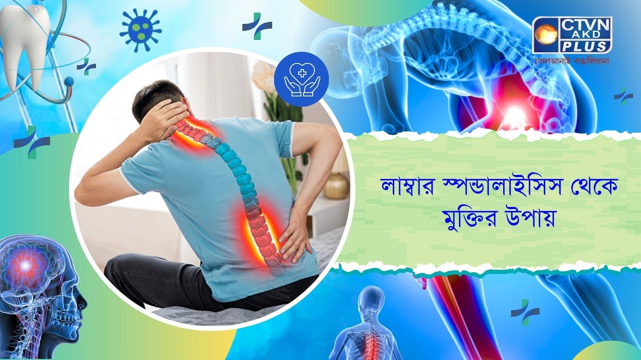 লাম্বার স্পন্ডালাইসিস থেকে মুক্তির উপায়। Health and Wellness