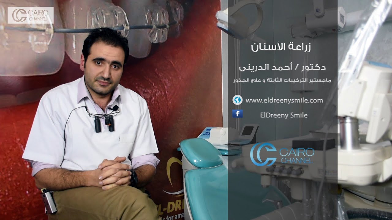 زراعة الأسنان - دكتور / أحمد الدرينى