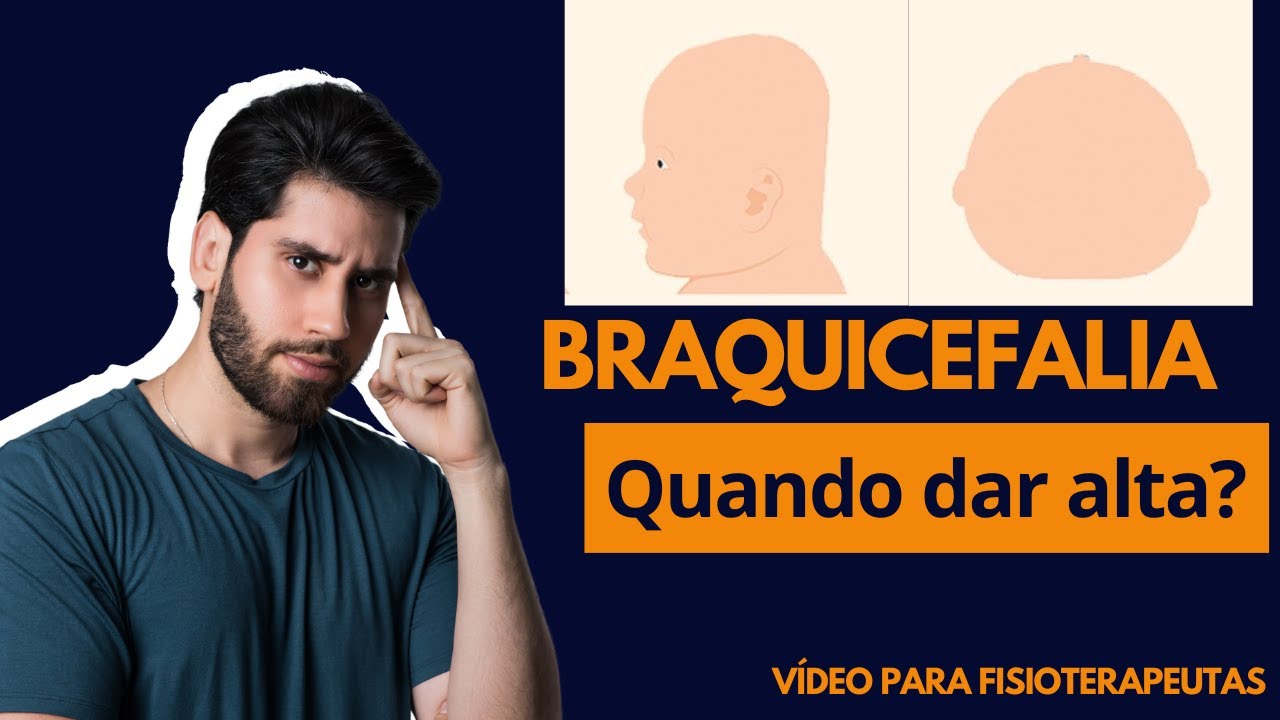 Quando dar alta no paciente com BRAQUICEFALIA? | Live com Dr. Icaro Ramalho