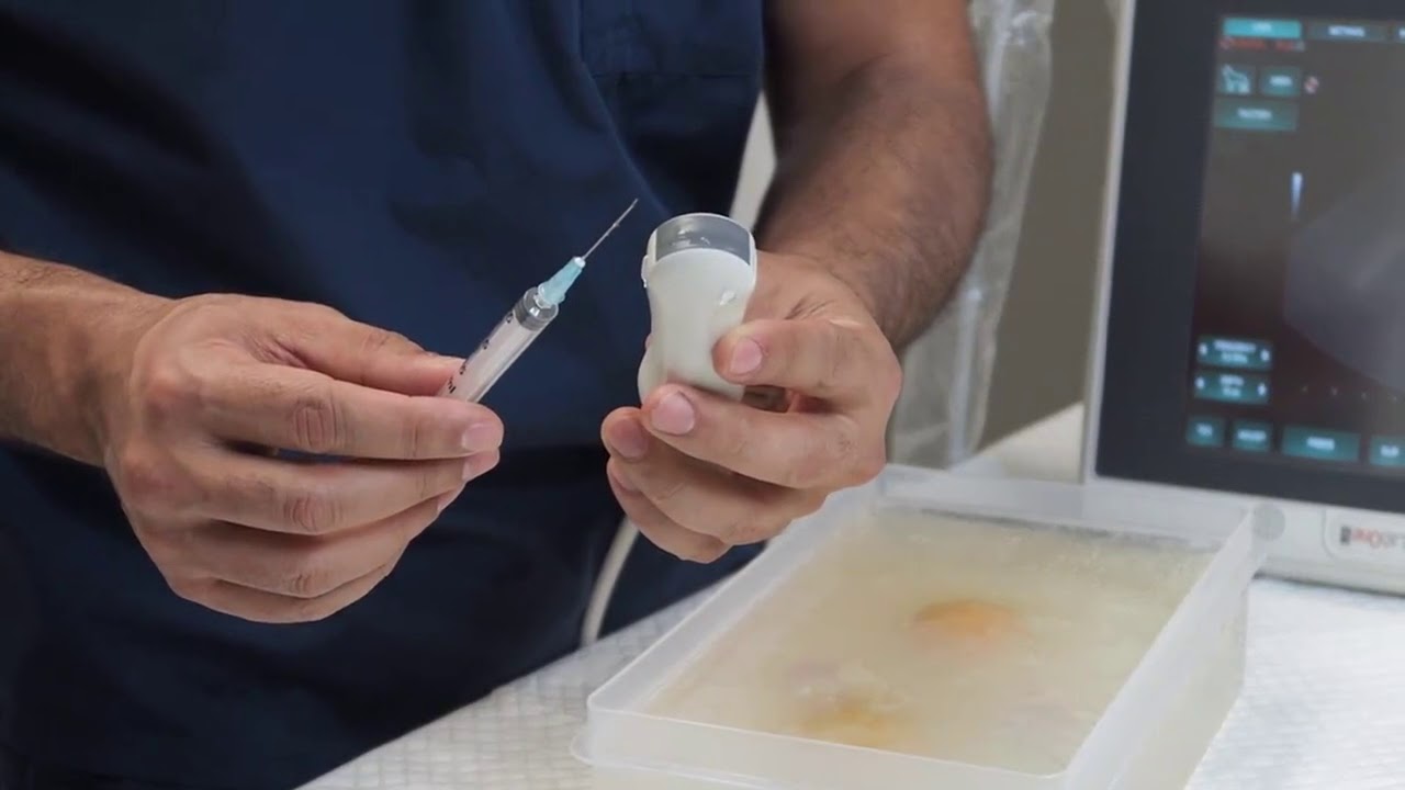 Vet Emergency Ultrasound: 4 Quick Tips To Improve Ultrasound Guided Aspirates.