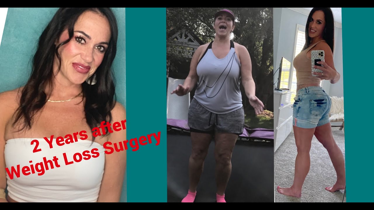 2 Years after Gastric Bypass + Food is Fuel + Butt Implants + Art Model + Sensuality | Weight Loss