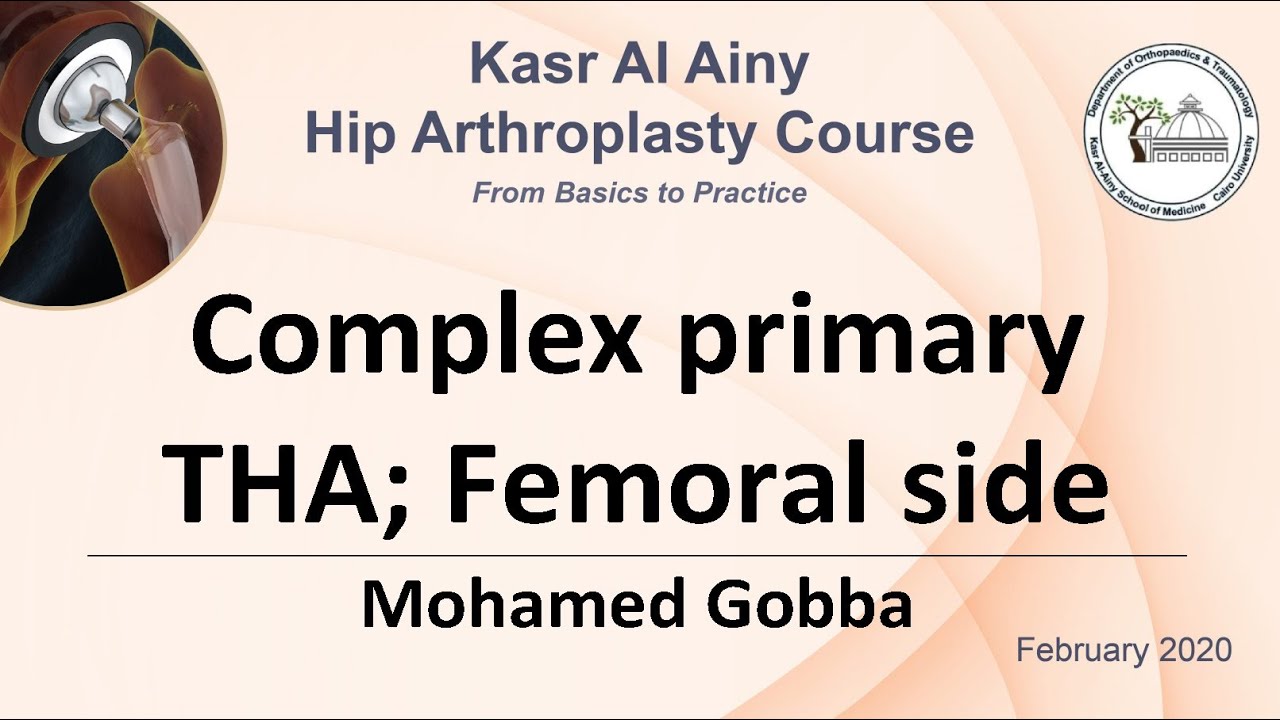 4-2 Complex primary THA; Femoral side - Mohamed Gobba