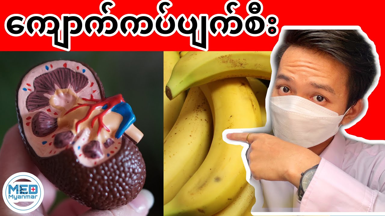 ကျောက်ကပ်မပျက်စီးအောင် သတိထားဆင်ခြင်ရမယ့် အစားအသောက် (၅) မျိုး