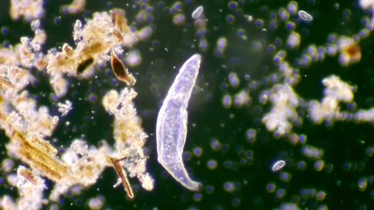 Bdelloid Rotifers and other specimens observed using dark-field microscopy
