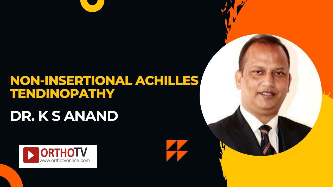 Non-insertional Achilles Tendinopathy - Dr. K S ANAND