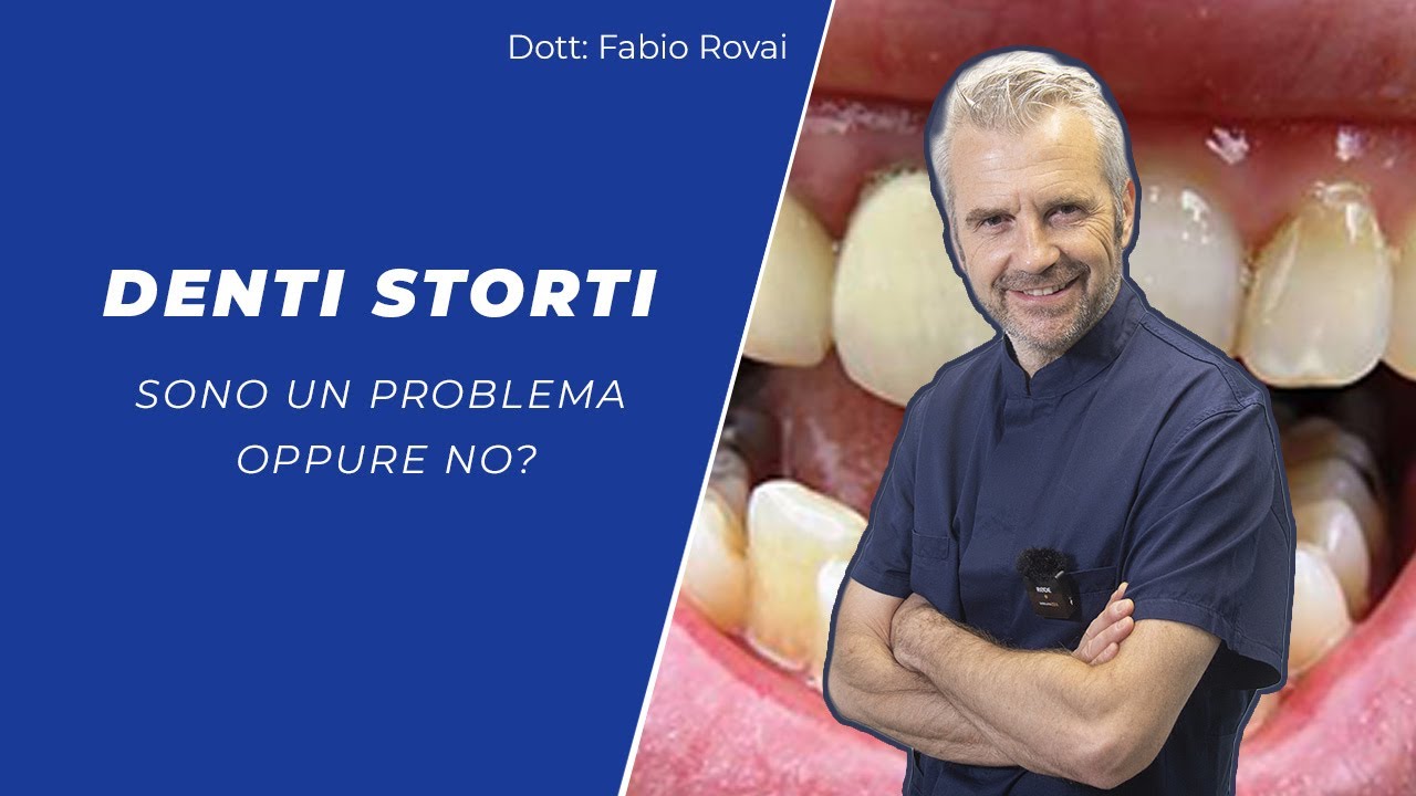 DENTI STORTI SONO UN PROBLEMA OPPURE NO?