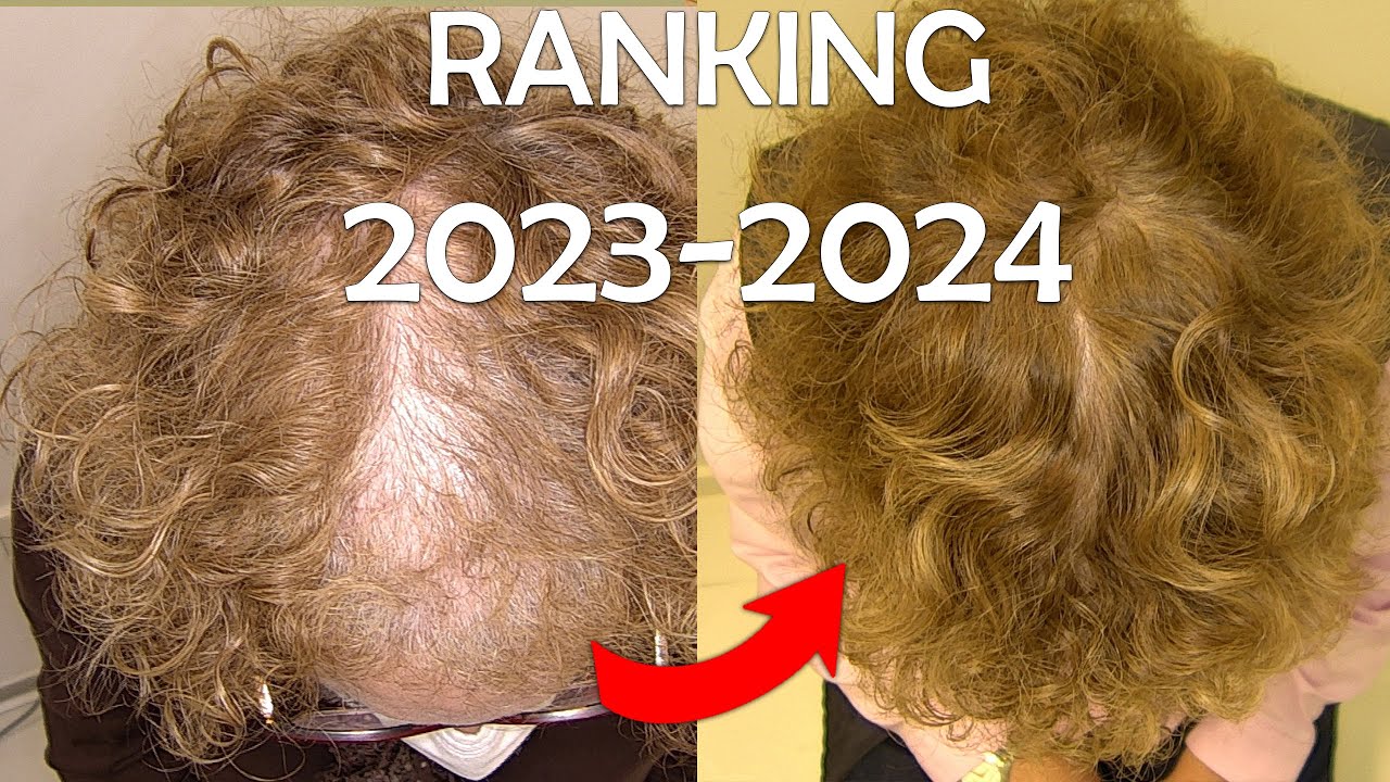 Alopecia femenina : ranking tratamiento según médico