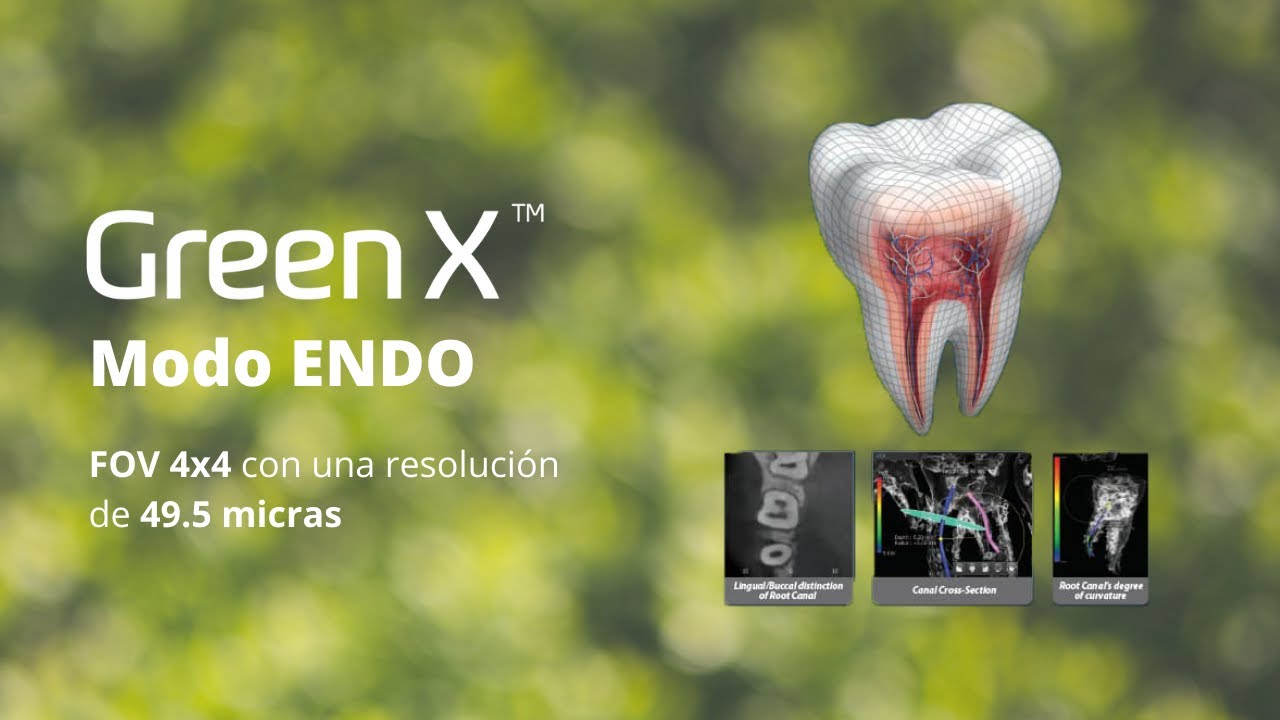 Modo #endo en Green X, el tamaño de voxel más pequeño!  #GreenX #vatech