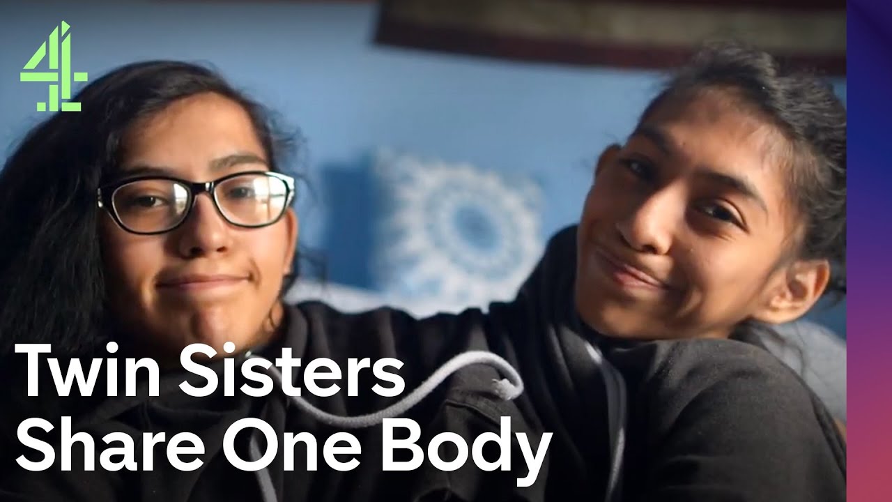 Our Life as Teenage Conjoined Twins | Two Sisters, One Body | Channel 4 Documentaries