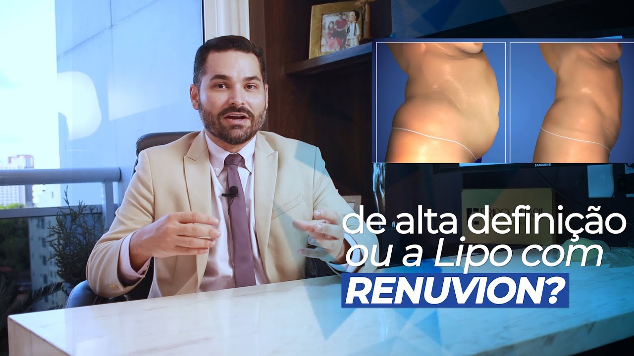 LIPO HD ou Renuvion são a mesma coisa? O que é melhor Lipo de alta definição ou Renuvion? Diferenças