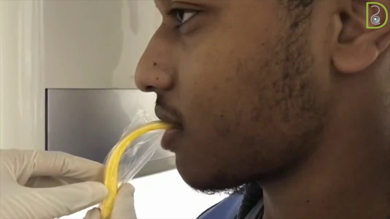 Dentiscope | How to Take Panoramic Radiograph