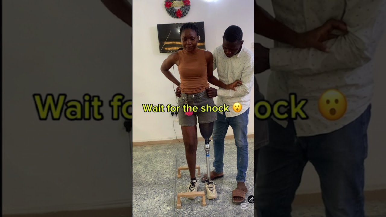 Walking with prosthetic leg training #ifebrownies111 #fypyoutube #viral #reels #fyp #youtube