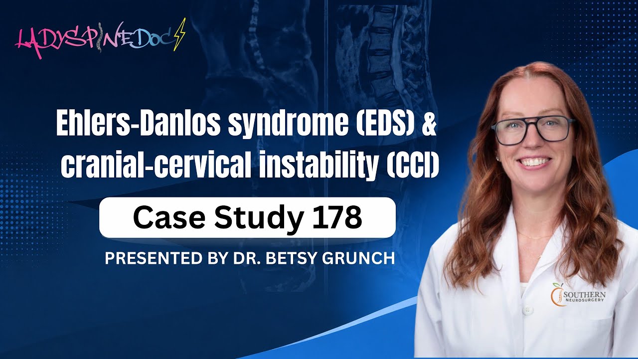Case Study 178 - Ehlers-Danlos syndrome (EDS) and cranial-cervical instability (CCI)