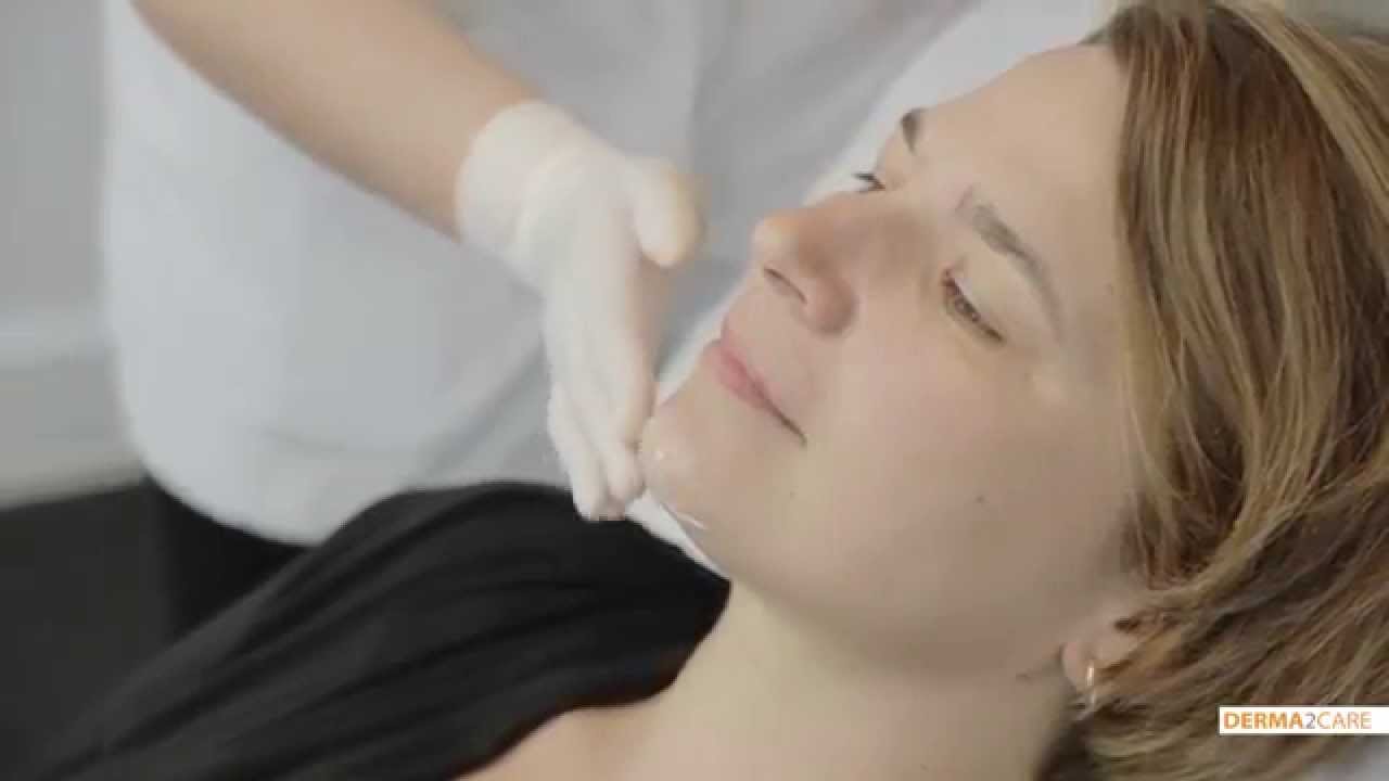 Laserontharing in het gezicht - De Huidkliniek
