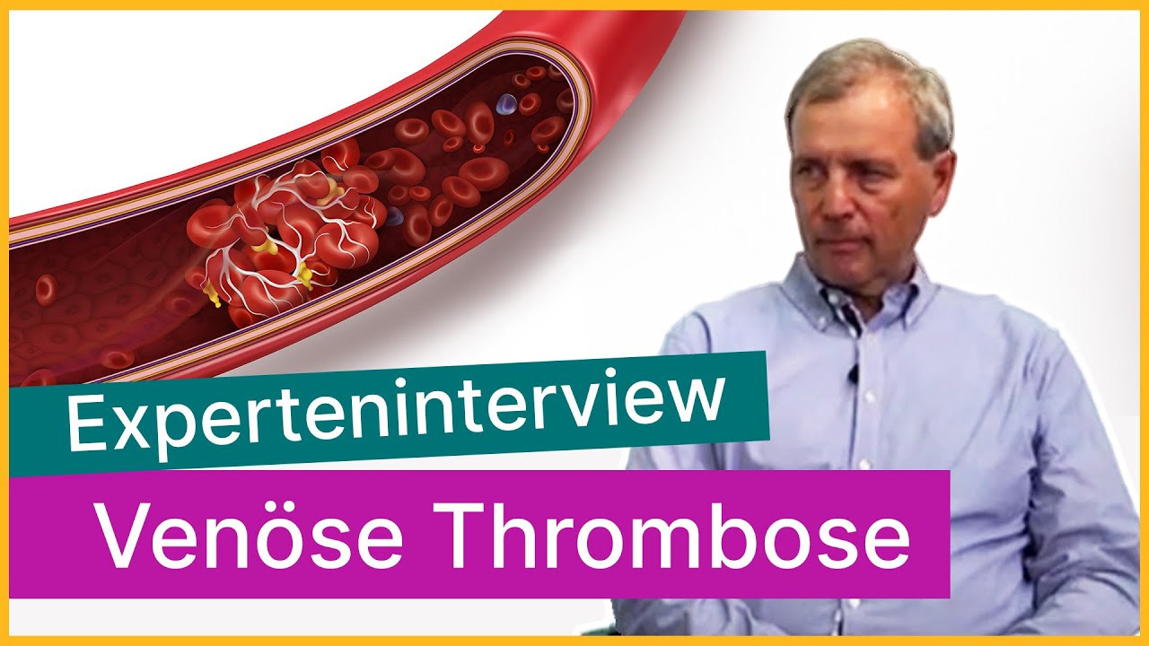Ven&ouml;se Thrombose: Blutgerinnsel in der Vene | Asklepios