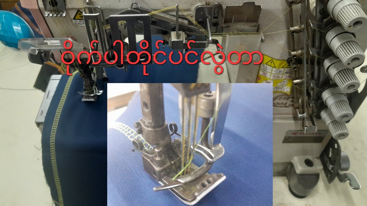 ကင်းဝိုက်ပါတိုင်ပင်လွဲတာလေး