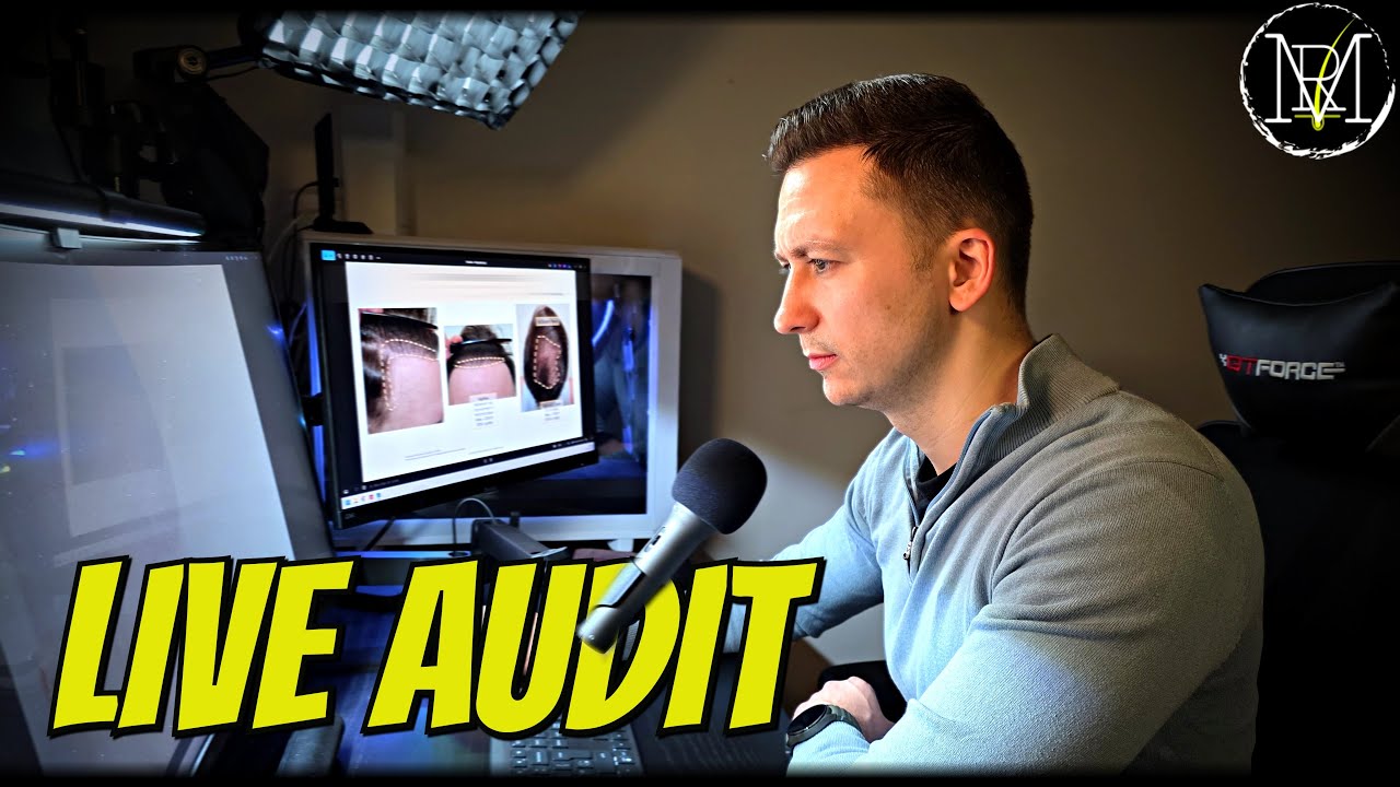 LIVE AUDIT: Rating Your Hair Transplant Results