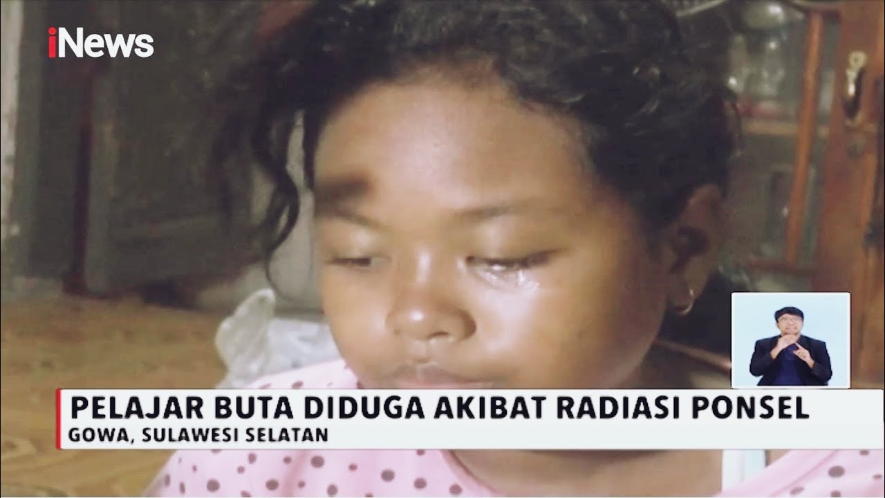 Siswi SD di Gowa Buta Diduga Akibat Radiasi HP saat Belajar Online - iNews Siang 20/11