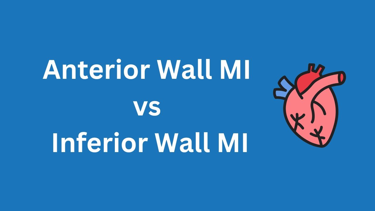 Difference between Anterior wall MI and Inferior wall MI | Myocardial Infarction | medCampus