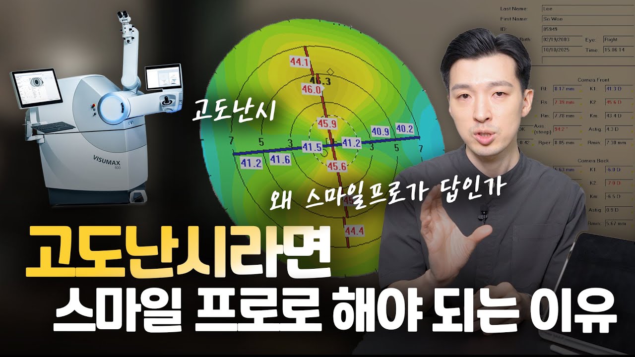 난시교정하면? 스마일프로 #SNU안과 #스마일프로