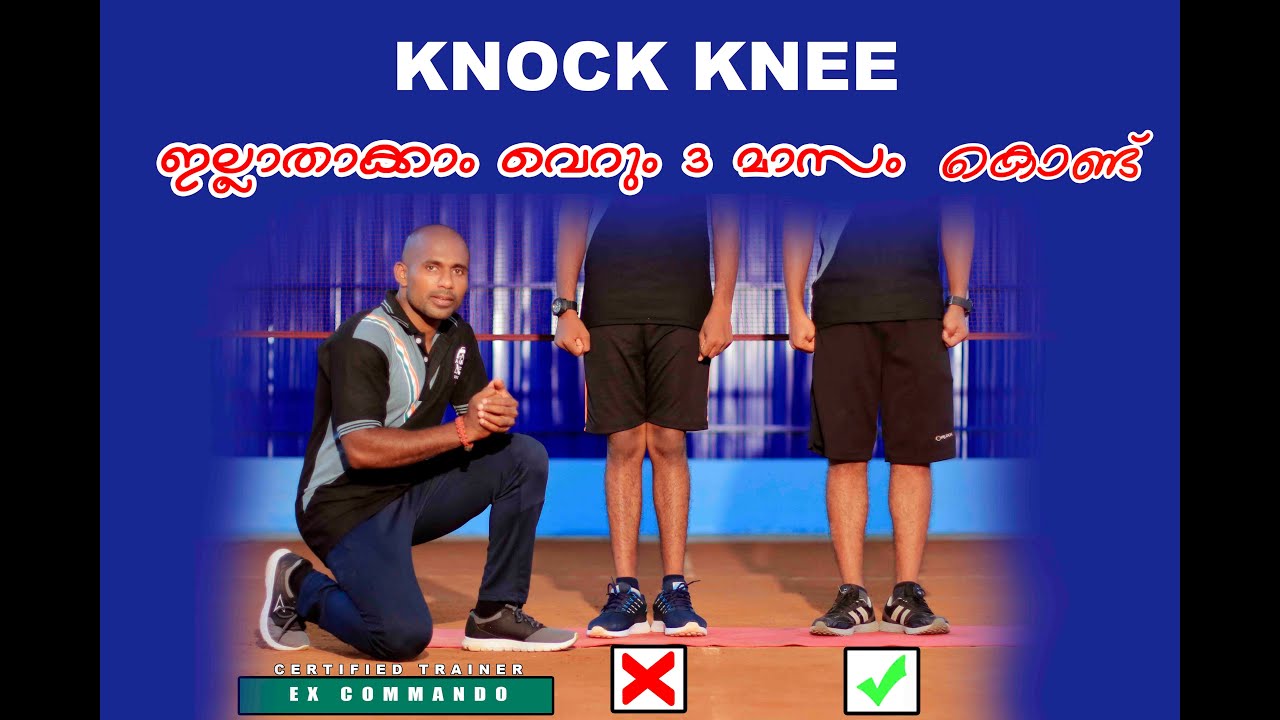 HOW TO SOLVE KNOCK KNEE PROBLEM FOR MEDICAL IN ARMY  /KNOCK KNEE CORRECTION EXERCISE IN MALAYALAM