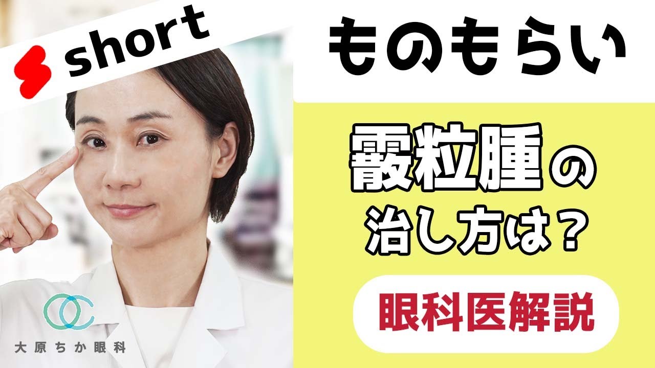 【ものもらい】痛くない「霰粒腫」の治し方は？#sorts