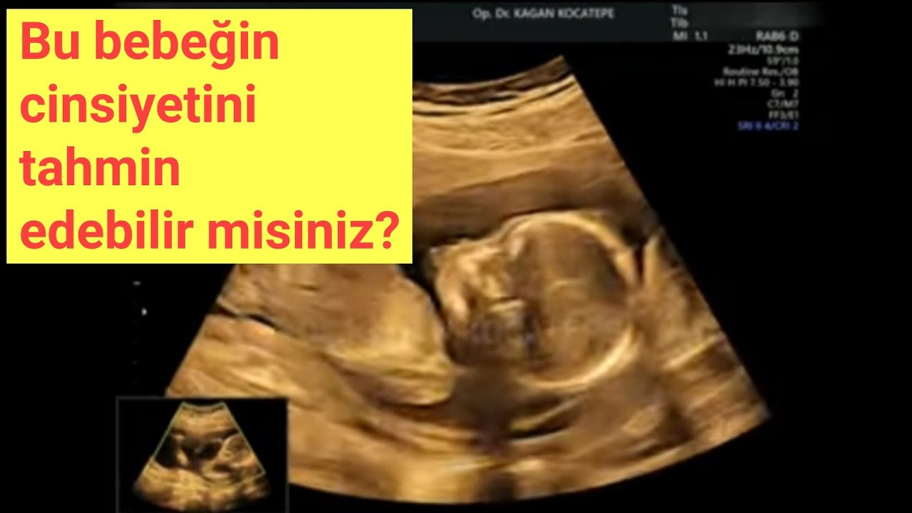 16 haftalık gebelik. Kız mı, erkek mi? Bu ultrason görüntülerinden cinsiyeti görmek mümkün mü?