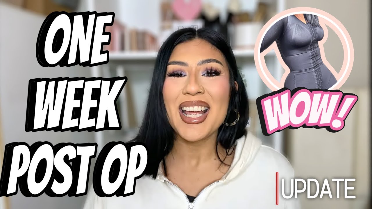 TUMMY TUCK REVISION* ONE WEEK UPDATE* ALMA RIVERA