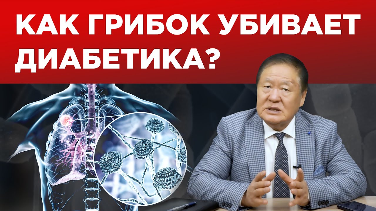 Грибок у диабетика / Как лечить? / Чем опасен?