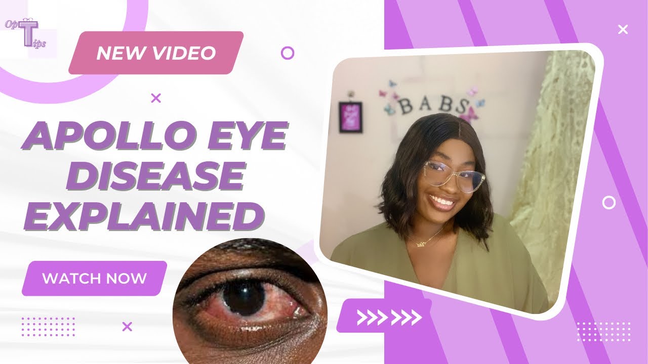 Apollo eye disease explained with prevention | optometry