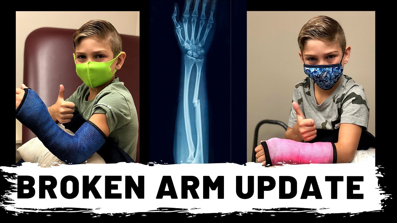 UPDATE | Broken Arm! EMERGENCY!