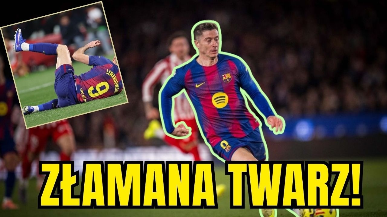 Lewandowski Strzelił Gola Z Połamaną Twarzą! Szokująca Diagnoza