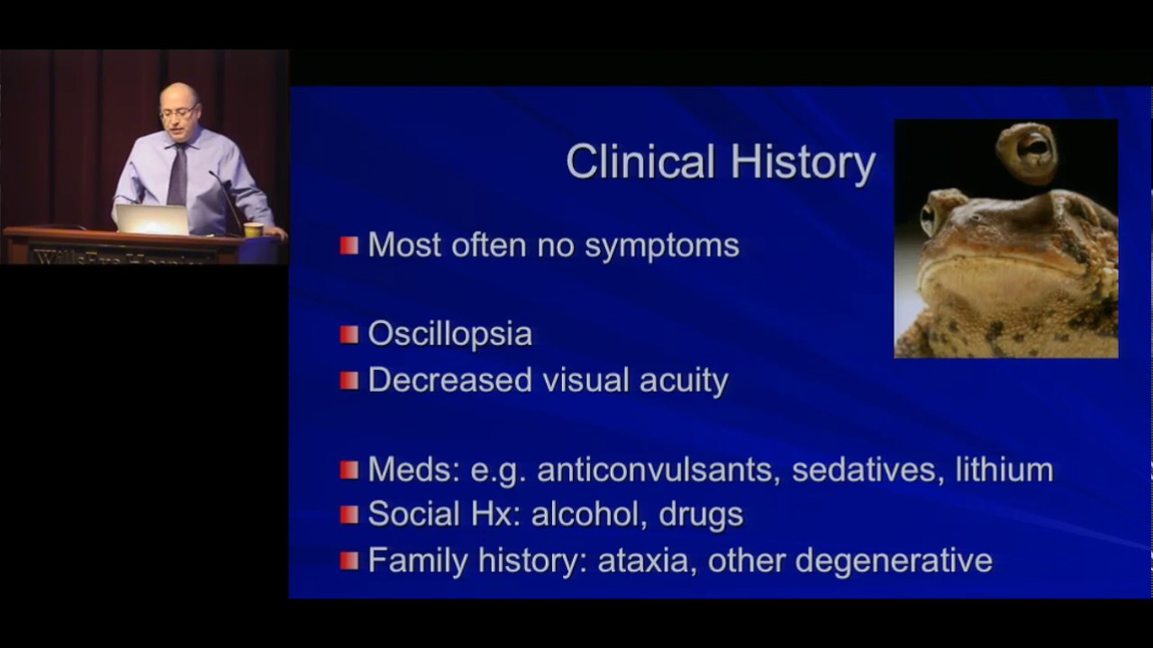 nystagmus