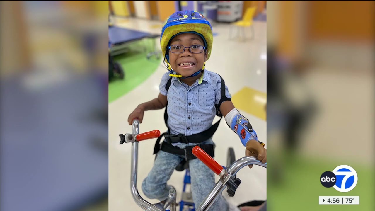 5-year-old taking on new life with prosthetic legs and arm after battling life-threatening illness