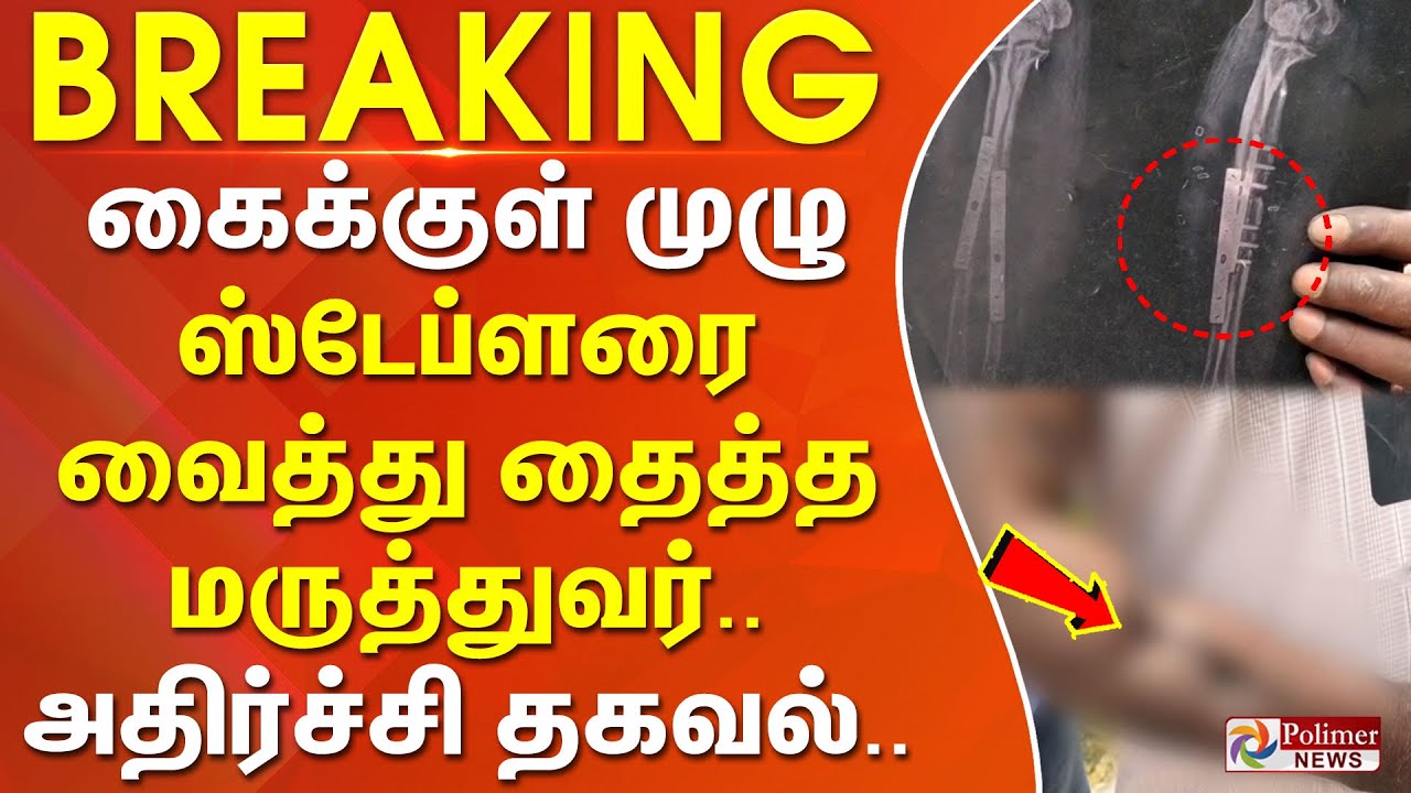 கைக்குள் முழு ஸ்டேப்ளரை வைத்து தைத்த மருத்துவர்.. அதிர்ச்சி தகவல்.. | #breakingnews