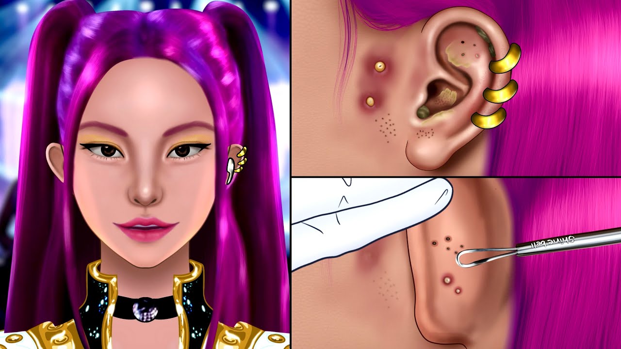 ASMR MIRA Satisfying Ear Acne Blackhead Removal Animation‼️, Kpop Demonhunters, Make up