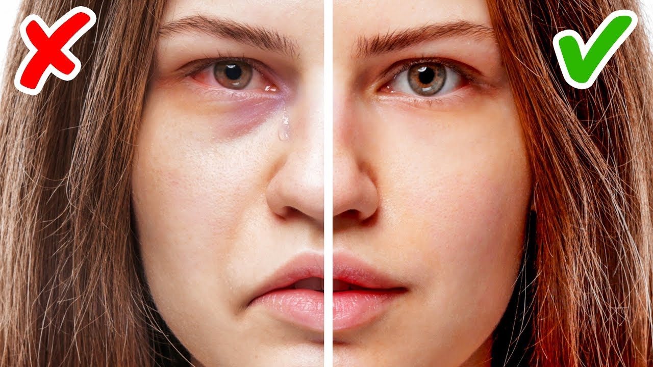 11 Zeichen für Gesundheitsprobleme, erkennbar an deinem Gesicht