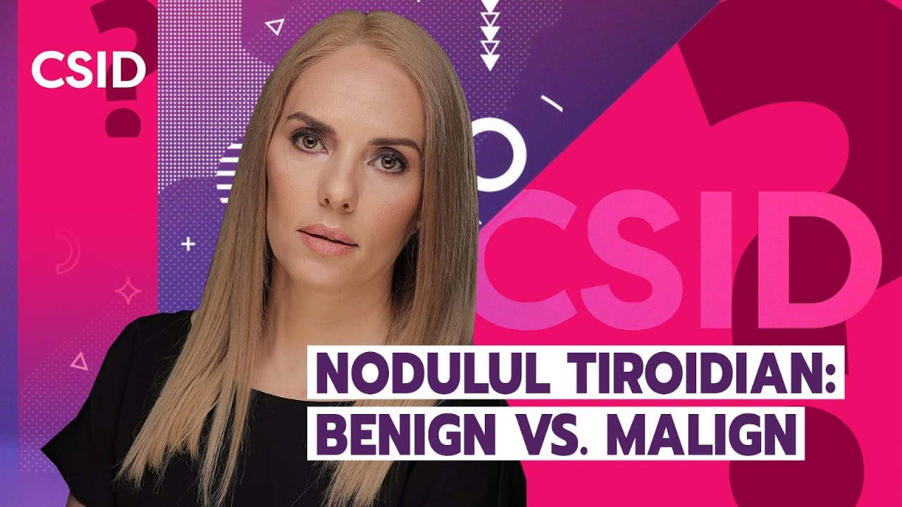Diferențele dintre un nodul tiroidian benign și unul malign