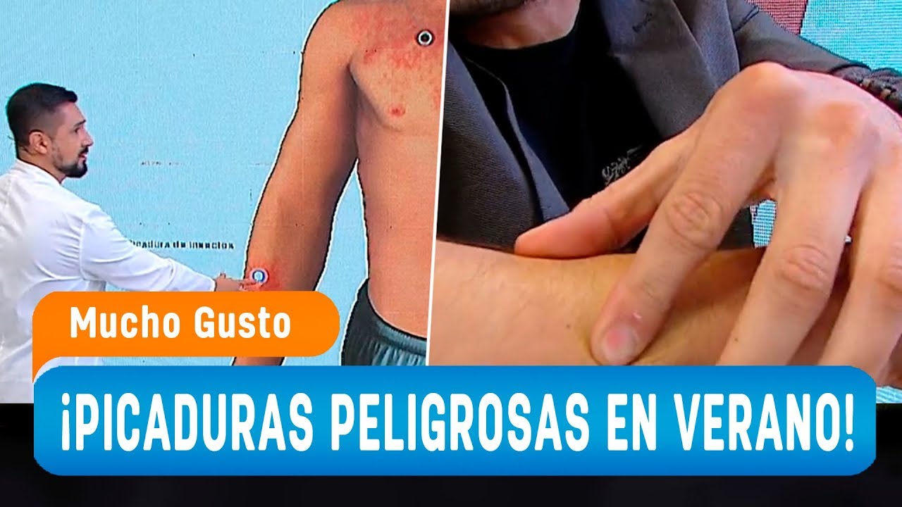 Doctor enseña a identificar cuando una picadura de insecto es peligrosa - Mucho Gusto