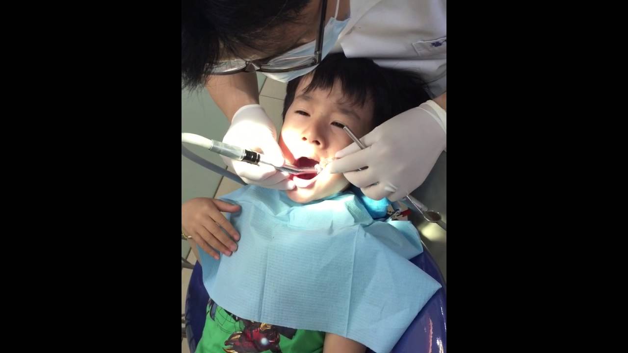 5歲小cc蛀牙了。勇敢治療（上）
